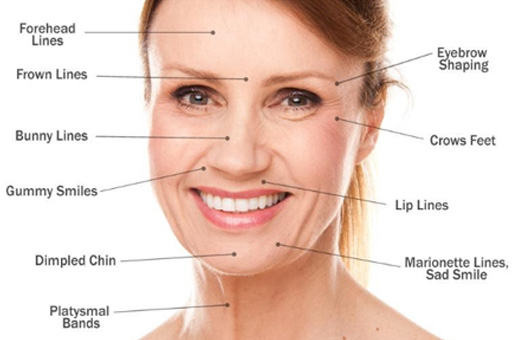 Lady image specifying lines of wrinkles